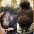 ORANIC EXTRACT® JUMBO Scalp Stimulator