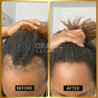 ORANIC EXTRACT® JUMBO Scalp Stimulator