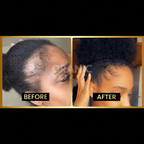 ORANIC EXTRACT® JUMBO Scalp Stimulator