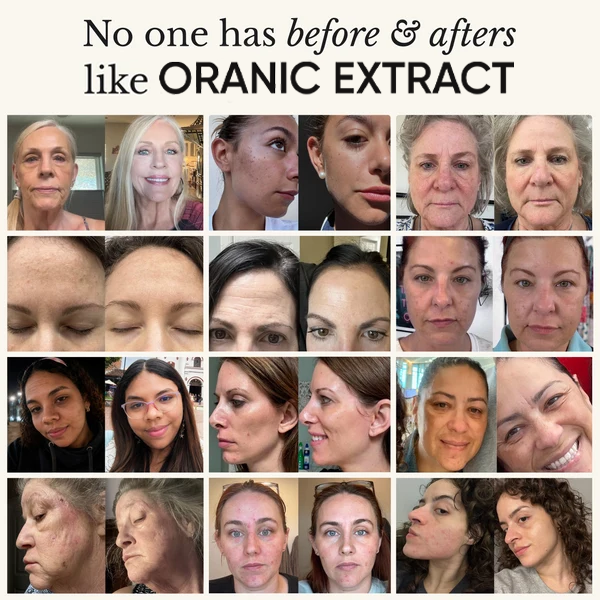 The Complete System for Mature Women’s Skin